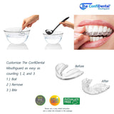 The ConfiDental - Pack of 5 Moldable Mouth Guard for Teeth Grinding Clenching Bruxism, Sport Athletic, Whitening Tray, Including 3 Regular
