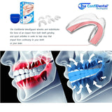 The ConfiDental - Pack of 5 Moldable Mouth Guard for Teeth Grinding Clenching Bruxism, Sport Athletic, Whitening Tray, Including 3 Regular